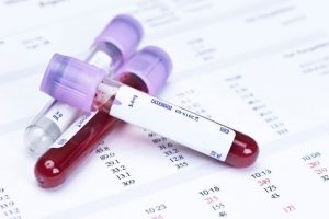 Ý nghĩa các chỉ số xét nghiệm tổng phân tích tế bào máu