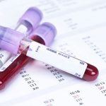 Ý nghĩa các chỉ số xét nghiệm tổng phân tích tế bào máu