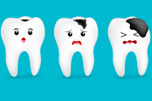 5 cách hạn chế sâu răng hiệu quả từ nha sĩ