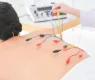 Các phương pháp điều trị đau thắt lưng